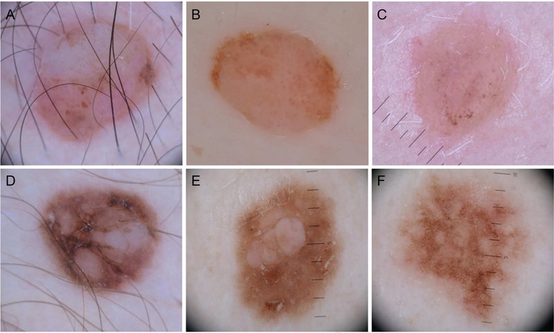 Fig 2.