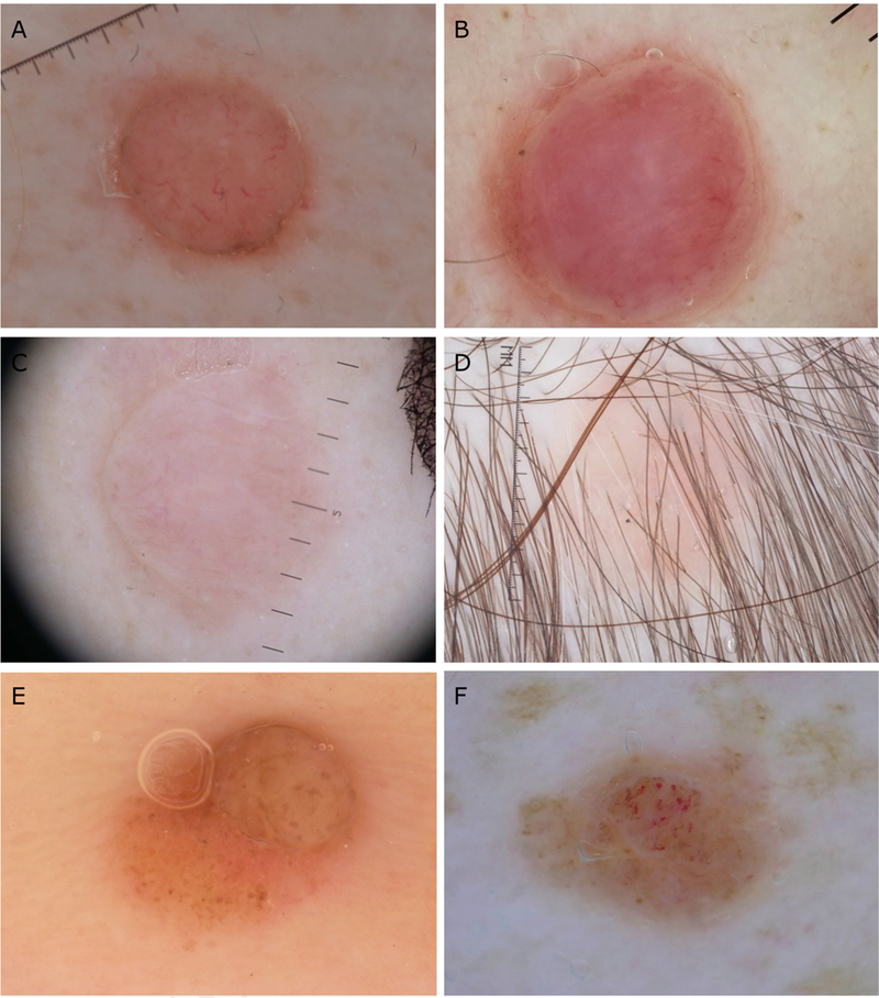 Fig 3.