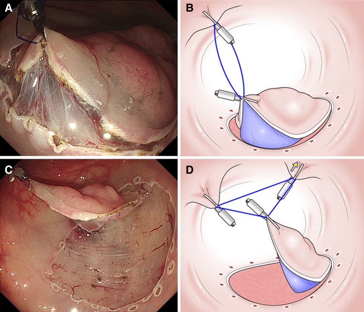 Fig. 2