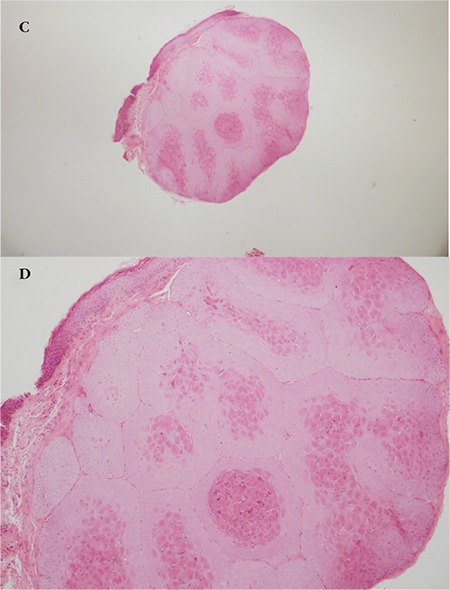 Figure 1C, 1D