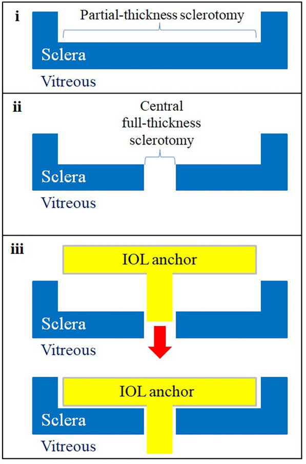 Fig. 1