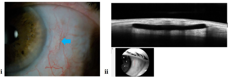 Fig. 3