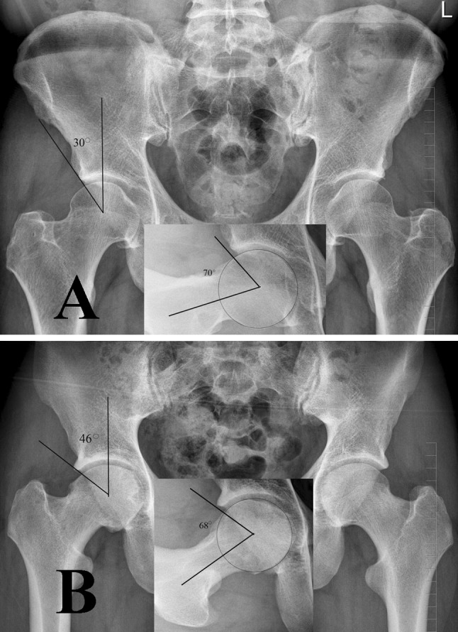 Fig. 4A–B