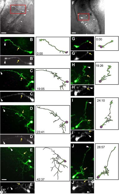 Figure 11