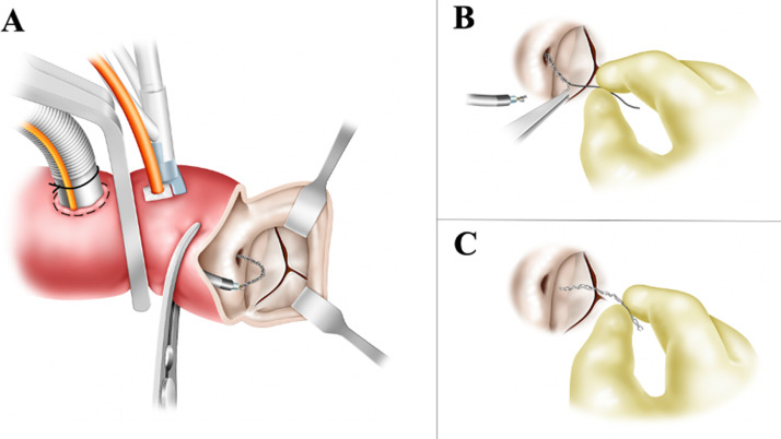 Fig 2