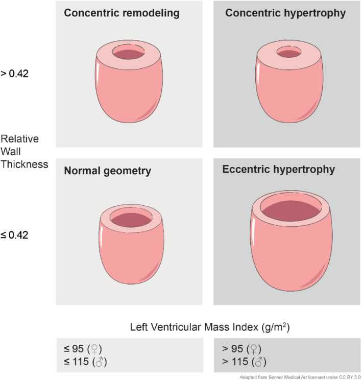 EJHF-1632-FIG-0001-c