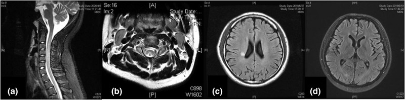 FIGURE 3