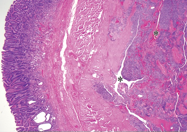 Figure 10c