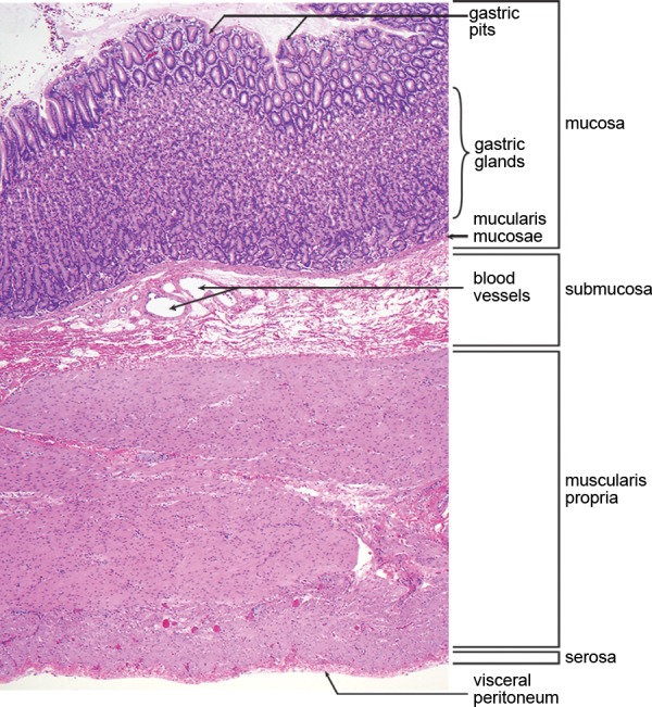 Figure 1b