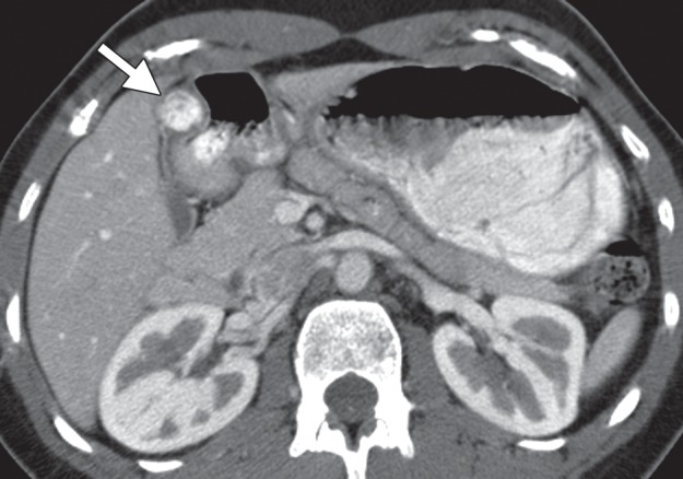 Figure 10a