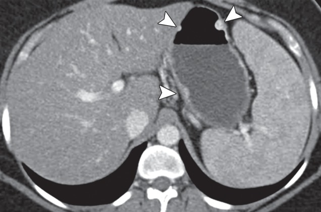 Figure 15d