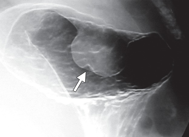 Figure 2e