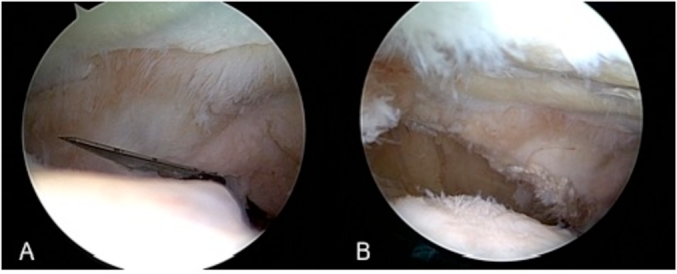 Fig. 4