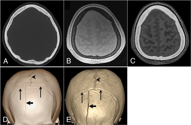 Fig 2.