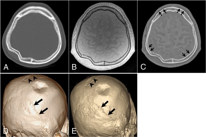 Fig 3.