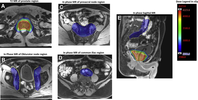 Fig. 1