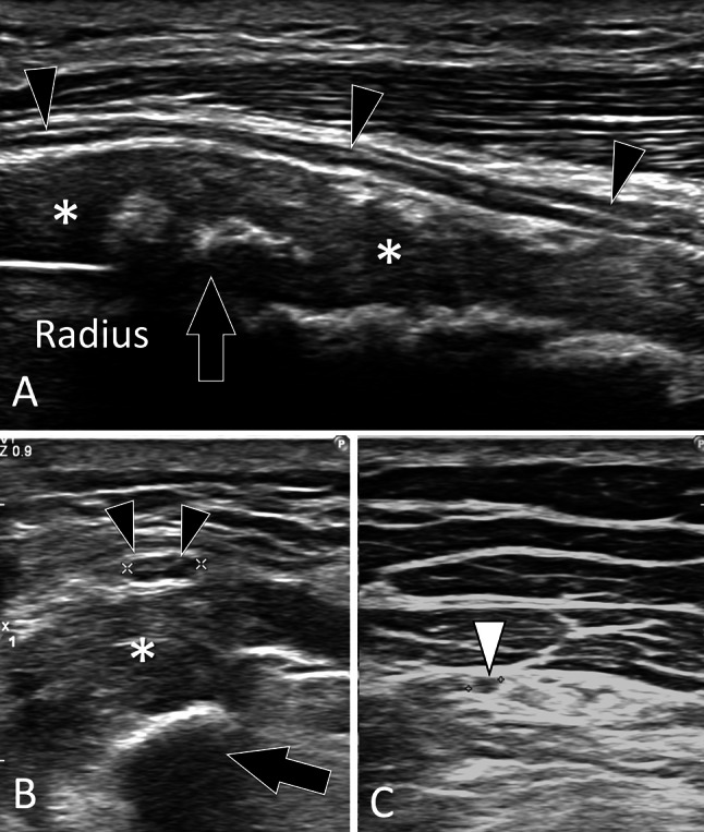 Fig. 17