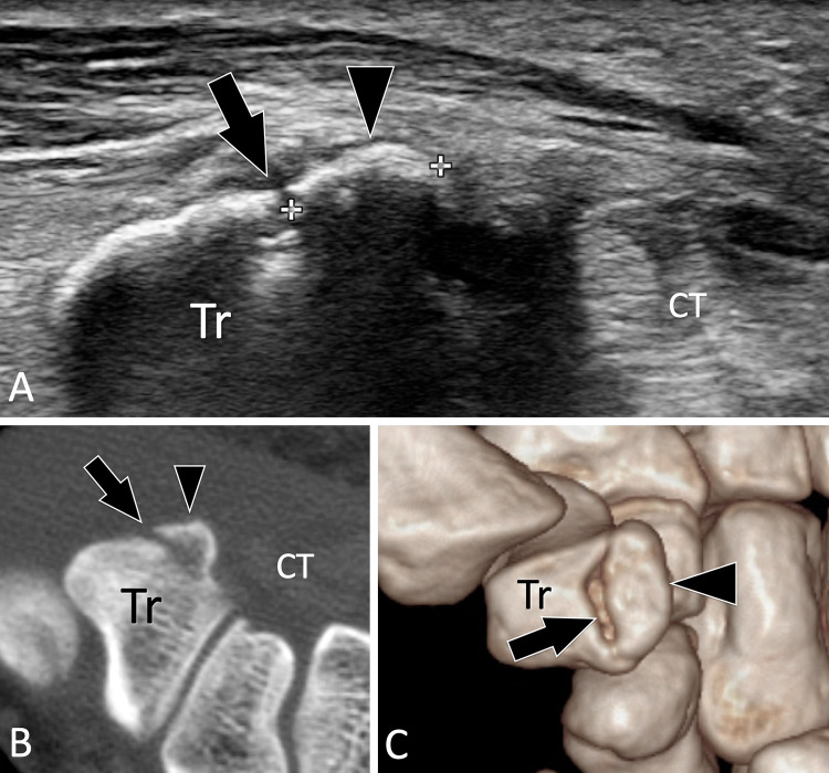 Fig. 14