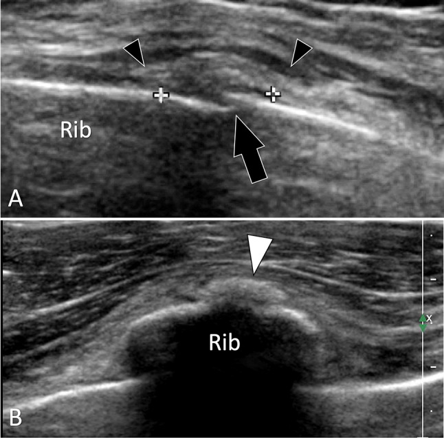 Fig. 12