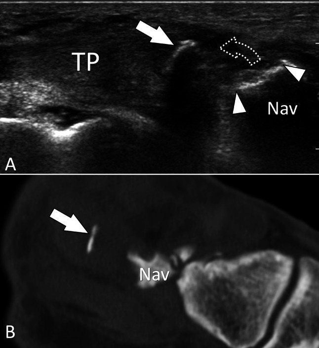 Fig. 27