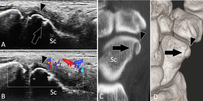 Fig. 13