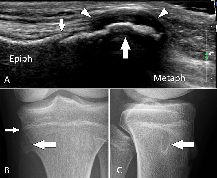 Fig. 37