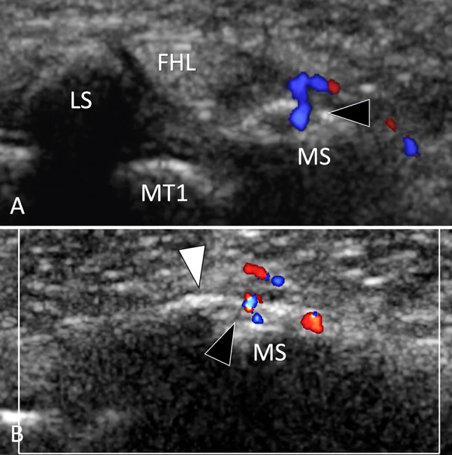 Fig. 35