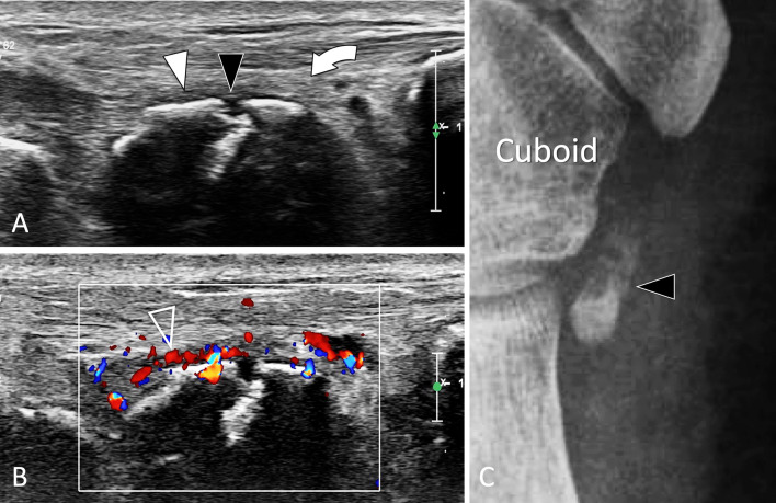 Fig. 33