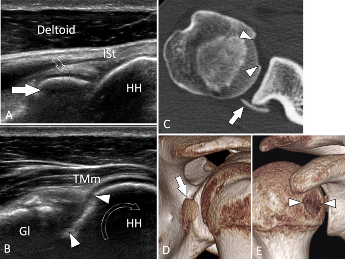 Fig. 23