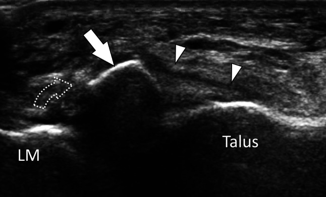 Fig. 29