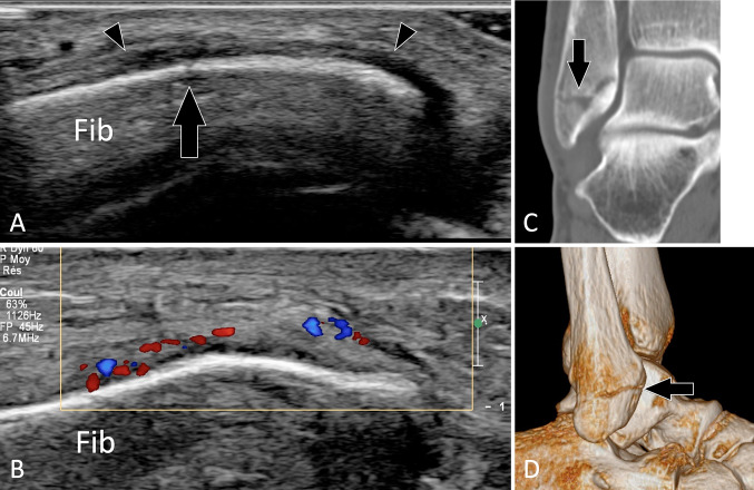 Fig. 15