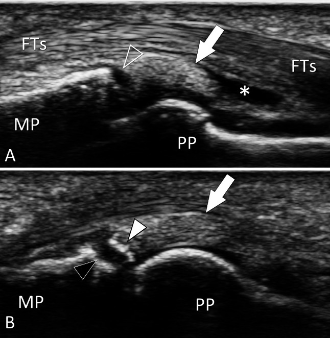 Fig. 25