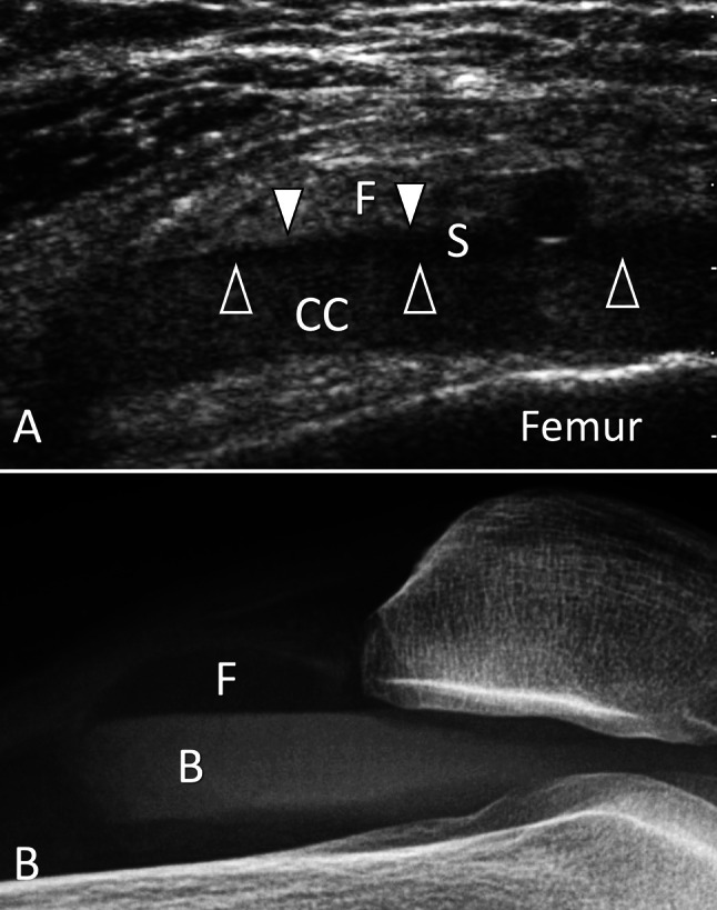 Fig. 20