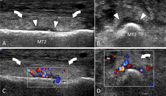 Fig. 34