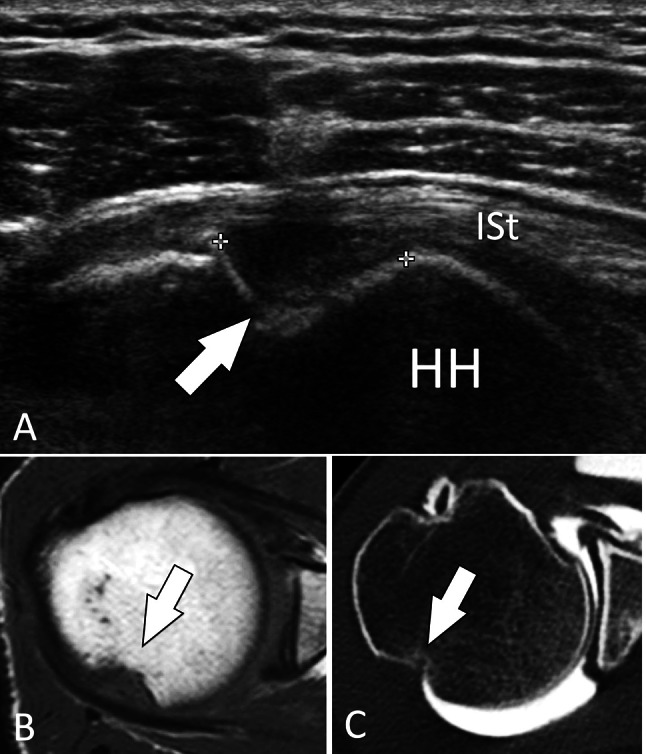 Fig. 21