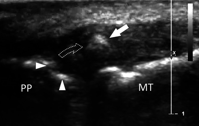 Fig. 24