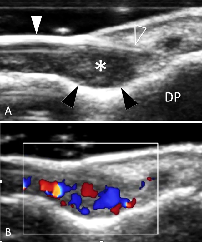 Fig. 40