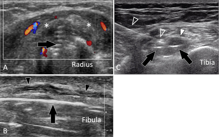 Fig. 18