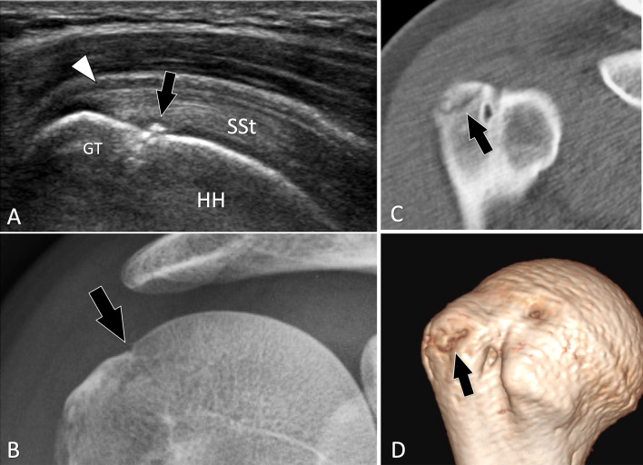 Fig. 11