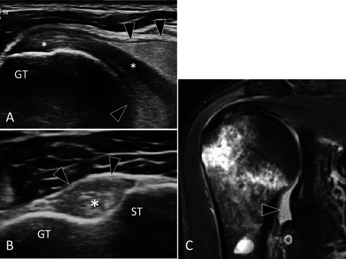 Fig. 19