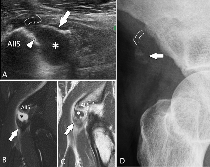 Fig. 26