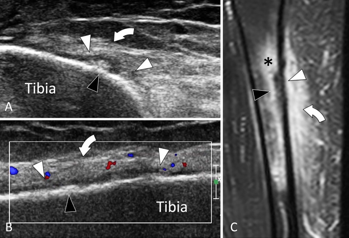 Fig. 31