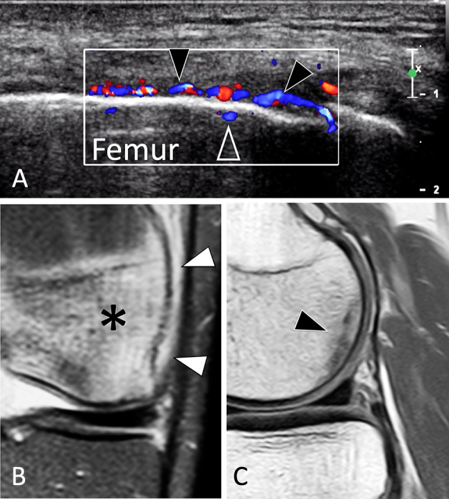 Fig. 30