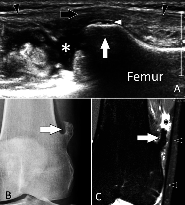 Fig. 38