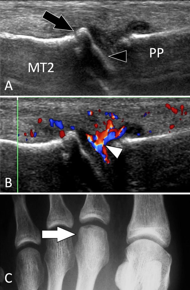 Fig. 22