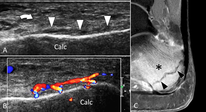 Fig. 32