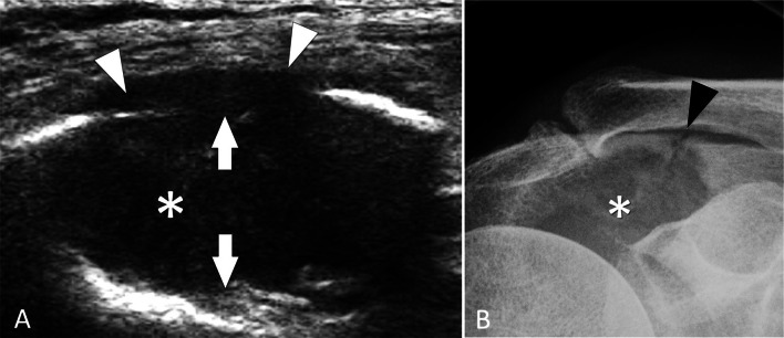 Fig. 39