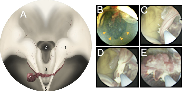 FIG. 2.