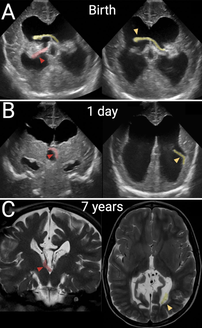 FIG. 4.