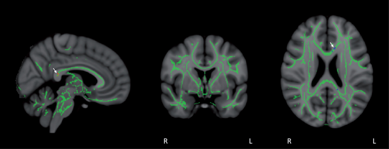 Fig.10